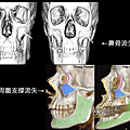 晶亮瓷微晶瓷晶亮瓷隆鼻墊晶亮瓷下巴豐額晶亮瓷價格晶亮瓷玻尿酸波酸豐唇晶亮瓷價位晶亮瓷醫師推薦03