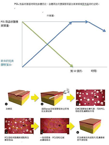 新Ellansé 洢蓮絲少女針PolycaprolactonePCL膠原增生劑洢蓮絲上立皮膚科林上立洢蓮絲3D聚左旋乳酸晶亮瓷微晶瓷隆鼻墊下巴拉提02.jpg