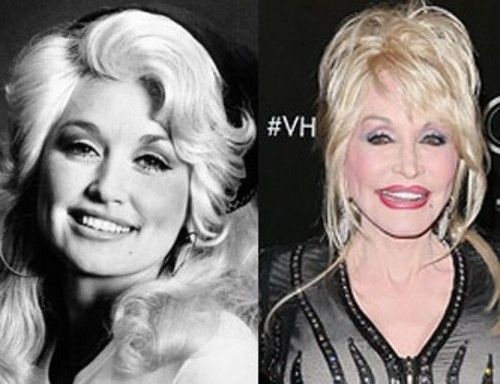 新Ellansé 洢蓮絲少女針PolycaprolactonePCL膠原增生劑洢蓮絲上立皮膚科林上立洢蓮絲3D聚左旋乳酸晶亮瓷微晶瓷隆鼻墊下巴拉提上立皮膚科 費用 林上立 價格 林上立 評價 液態拉皮上立提 液態拉皮 推薦液態拉皮Ellanse洢蓮絲易麗適依戀詩02.jpg 新Ellansé 洢蓮絲少女針PolycaprolactonePCL膠原增生劑洢蓮絲上立皮膚科林上立洢蓮絲3D聚左旋乳酸晶亮瓷微晶瓷隆鼻墊下巴拉提上立皮膚科 費用 林上立 價格 林上立 評價 液態拉皮上立提 液態拉皮 推薦液態拉皮Ellanse洢蓮絲易麗適依戀詩02.jpg