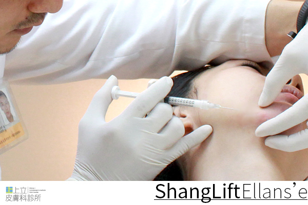 Ellanse洢蓮絲易麗適依戀詩新Ellansé 洢蓮絲少女針PolycaprolactonePCL膠原增生劑洢蓮絲上立皮膚科林上立洢蓮絲上立皮膚科 費用 林上立 價格 林上立 評價 液態拉皮上立提 液態拉皮 推薦液態拉皮聚己內酯07.jpg Ellanse洢蓮絲易麗適依戀詩新Ellansé 洢蓮絲少女針PolycaprolactonePCL膠原增生劑洢蓮絲上立皮膚科林上立洢蓮絲上立皮膚科 費用 林上立 價格 林上立 評價 液態拉皮上立提 液態拉皮 推薦液態拉皮聚己內酯07.jpg