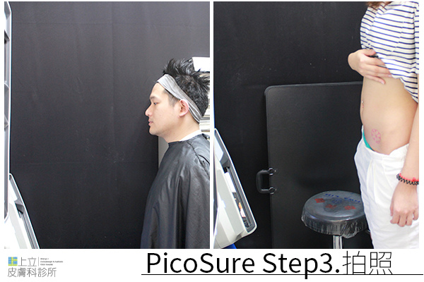 PicoSure蜂巢皮秒除皺雷射 除皺雷射 蜂巢皮秒機械光755雷射 淨膚雷射蜂巢瞬效透鏡 蜂巢皮秒機械光雷射PicoSure皮秒雷射雀斑曬斑 細紋眼下細紋毛孔粗大飛梭雷射縮毛孔淨膚雷射皮秒雷射價格皮秒雷射價錢皮秒雷射凹洞皮秒雷射除斑皮秒雷射刺青03.jpg PicoSure蜂巢皮秒除皺雷射 除皺雷射 蜂巢皮秒機械光755雷射 淨膚雷射蜂巢瞬效透鏡 蜂巢皮秒機械光雷射PicoSure皮秒雷射雀斑曬斑 細紋眼下細紋毛孔粗大飛梭雷射縮毛孔淨膚雷射皮秒雷射價格皮秒雷射價錢皮秒雷射凹洞皮秒雷射除斑皮秒雷射刺青03.jpg