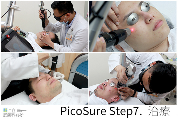PicoSure蜂巢皮秒除皺雷射 除皺雷射 蜂巢皮秒機械光755雷射 淨膚雷射蜂巢瞬效透鏡 蜂巢皮秒機械光雷射PicoSure皮秒雷射雀斑曬斑 細紋眼下細紋毛孔粗大飛梭雷射縮毛孔淨膚雷射皮秒雷射價格皮秒雷射價錢皮秒雷射凹洞皮秒雷射除斑皮秒雷射刺青07.jpg PicoSure蜂巢皮秒除皺雷射 除皺雷射 蜂巢皮秒機械光755雷射 淨膚雷射蜂巢瞬效透鏡 蜂巢皮秒機械光雷射PicoSure皮秒雷射雀斑曬斑 細紋眼下細紋毛孔粗大飛梭雷射縮毛孔淨膚雷射皮秒雷射價格皮秒雷射價錢皮秒雷射凹洞皮秒雷射除斑皮秒雷射刺青07.jpg