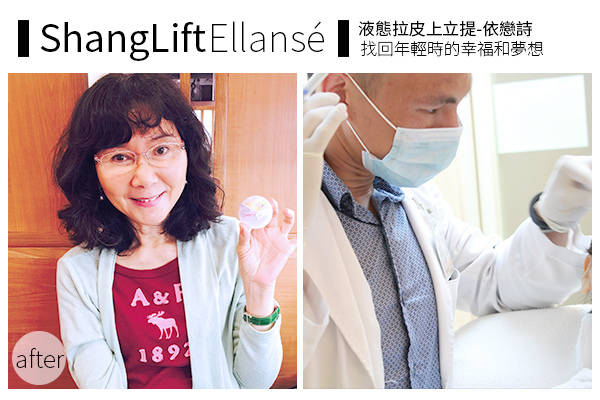 新Ellansé 洢蓮絲少女針