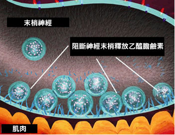 肉毒桿菌價錢肉毒桿菌費用肉毒桿菌瘦小臉肉毒桿菌除皺肉毒桿菌效果上立皮膚科林上立肉毒桿菌推薦06.jpg