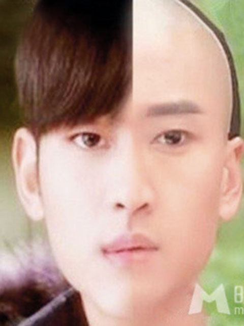 少女計劃林上立醫生液態拉皮上立提 液態拉皮 推薦 Ellansé 洢蓮絲少女針PolycaprolactonePCL膠原增生劑易麗適依戀詩額頭PicoSure蜂巢皮秒除皺雷射 除皺雷射 蜂巢皮秒機械光755雷射 淨膚雷射蜂巢瞬效透鏡 蜂巢皮秒機械光雷射PicoSure皮秒雷射雀斑曬斑 細紋眼下細紋毛孔粗大飛梭雷射縮毛孔淨膚雷射皮秒雷射價格皮秒雷射價錢皮秒雷射凹洞皮秒雷射除斑皮秒雷射刺青02.jpg 少女計劃林上立醫生液態拉皮上立提 液態拉皮 推薦 Ellansé 洢蓮絲少女針PolycaprolactonePCL膠原增生劑易麗適依戀詩額頭PicoSure蜂巢皮秒除皺雷射 除皺雷射 蜂巢皮秒機械光755雷射 淨膚雷射蜂巢瞬效透鏡 蜂巢皮秒機械光雷射PicoSure皮秒雷射雀斑曬斑 細紋眼下細紋毛孔粗大飛梭雷射縮毛孔淨膚雷射皮秒雷射價格皮秒雷射價錢皮秒雷射凹洞皮秒雷射除斑皮秒雷射刺青02.jpg