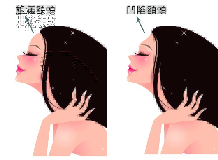 少女計劃林上立醫生液態拉皮上立提 液態拉皮 推薦 Ellansé 洢蓮絲少女針PolycaprolactonePCL膠原增生劑易麗適依戀詩額頭PicoSure蜂巢皮秒除皺雷射 除皺雷射 蜂巢皮秒機械光755雷射 淨膚雷射蜂巢瞬效透鏡 蜂巢皮秒機械光雷射PicoSure皮秒雷射雀斑曬斑 細紋眼下細紋毛孔粗大飛梭雷射縮毛孔淨膚雷射皮秒雷射價格皮秒雷射價錢皮秒雷射凹洞皮秒雷射除斑皮秒雷射刺青06.jpg 少女計劃林上立醫生液態拉皮上立提 液態拉皮 推薦 Ellansé 洢蓮絲少女針PolycaprolactonePCL膠原增生劑易麗適依戀詩額頭PicoSure蜂巢皮秒除皺雷射 除皺雷射 蜂巢皮秒機械光755雷射 淨膚雷射蜂巢瞬效透鏡 蜂巢皮秒機械光雷射PicoSure皮秒雷射雀斑曬斑 細紋眼下細紋毛孔粗大飛梭雷射縮毛孔淨膚雷射皮秒雷射價格皮秒雷射價錢皮秒雷射凹洞皮秒雷射除斑皮秒雷射刺青06.jpg