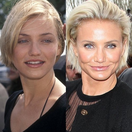 PicoSure755皮秒雷射蜂巢透鏡 皮秒雷射 二代皮秒上立皮膚科 費用 林上立 價格 林上立 評價 液態拉皮上立提 液態拉皮 推薦 少女計劃01 PicoSure755皮秒雷射蜂巢透鏡 皮秒雷射 二代皮秒上立皮膚科 費用 林上立 價格 林上立 評價 液態拉皮上立提 液態拉皮 推薦 少女計劃01