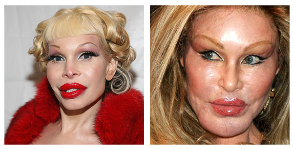 PicoSure755皮秒雷射蜂巢透鏡 皮秒雷射 二代皮秒上立皮膚科 費用 林上立 價格 林上立 評價 液態拉皮上立提 液態拉皮 推薦 少女計劃03 PicoSure755皮秒雷射蜂巢透鏡 皮秒雷射 二代皮秒上立皮膚科 費用 林上立 價格 林上立 評價 液態拉皮上立提 液態拉皮 推薦 少女計劃03