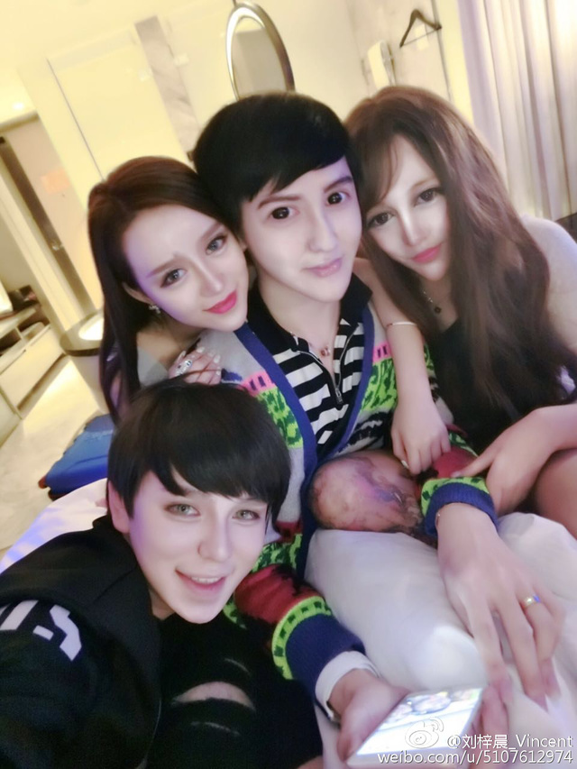 PicoSure755皮秒雷射蜂巢透鏡 皮秒雷射 二代皮秒上立皮膚科 費用 林上立 價格 林上立 評價 液態拉皮上立提 液態拉皮 推薦 少女計劃04 PicoSure755皮秒雷射蜂巢透鏡 皮秒雷射 二代皮秒上立皮膚科 費用 林上立 價格 林上立 評價 液態拉皮上立提 液態拉皮 推薦 少女計劃04