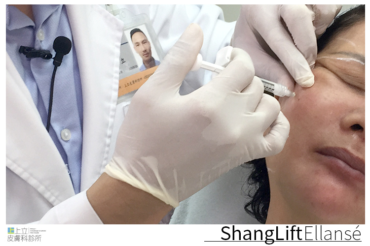 Ellansé依戀詩 液態拉皮§身體會老,但心靈不會│診間故事 04 Ellansé依戀詩 液態拉皮§身體會老,但心靈不會│診間故事 04