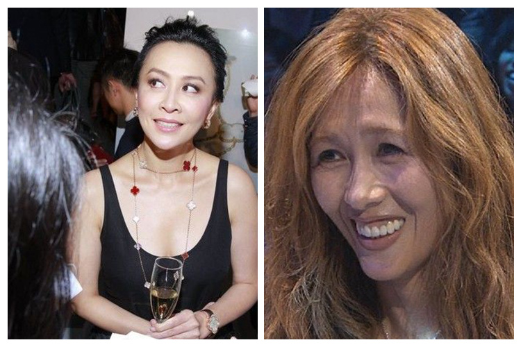 少女計劃林上立醫生液態拉皮上立提 液態拉皮 推薦 3D聚左旋乳酸 舒顏萃 童顏針 3D聚左旋乳酸 價格 3D聚左旋乳酸 費用 Ellansé 洢蓮絲少女針PolycaprolactonePCL膠原增生劑易麗適依戀詩01.jpg 少女計劃林上立醫生液態拉皮上立提 液態拉皮 推薦 3D聚左旋乳酸 舒顏萃 童顏針 3D聚左旋乳酸 價格 3D聚左旋乳酸 費用 Ellansé 洢蓮絲少女針PolycaprolactonePCL膠原增生劑易麗適依戀詩01.jpg