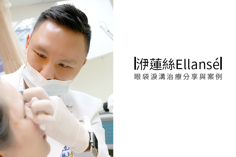 少女計劃林上立醫生液態拉皮上立提 液態拉皮 推薦 Ellansé 洢蓮絲少女針PolycaprolactonePCL膠原增生劑易麗適依戀詩聚己內酯.jpg