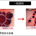 picosure755皮秒雷射蜂巢皮秒雷射蜂巢透鏡二代皮秒超皮秒新一代皮秒淨膚雷射飛梭雷射6.png