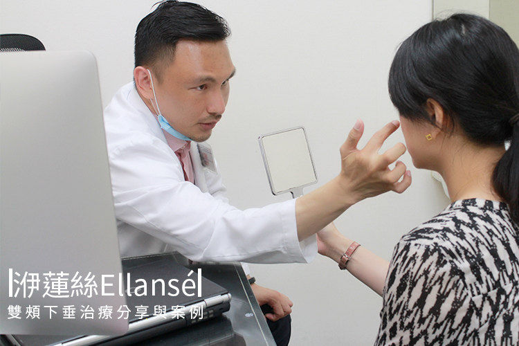 林上立醫生液態拉皮上立提Ellansé 洢蓮絲少女針PolycaprolactonePCL膠原增生劑易麗適依戀詩聚己內酯 洢蓮絲雙頰下垂蘋果肌拉提緊實.jpg 林上立醫生液態拉皮上立提Ellansé 洢蓮絲少女針PolycaprolactonePCL膠原增生劑易麗適依戀詩聚己內酯 洢蓮絲雙頰下垂蘋果肌拉提緊實.jpg