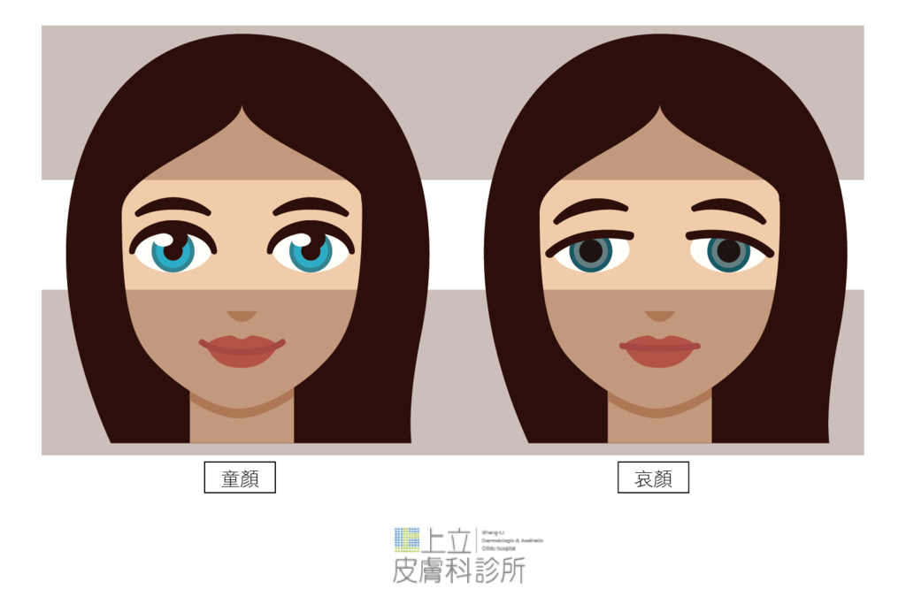 林上立醫生液態拉皮上立提Ellansé 洢蓮絲少女針PolycaprolactonePCL膠原增生劑易麗適依戀詩聚己內酯 洢蓮絲眼尾下垂 洢蓮絲眉毛下垂眼周緊實02 林上立醫生液態拉皮上立提Ellansé 洢蓮絲少女針PolycaprolactonePCL膠原增生劑易麗適依戀詩聚己內酯 洢蓮絲眼尾下垂 洢蓮絲眉毛下垂眼周緊實02