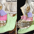 facial-bones-110105-02.png