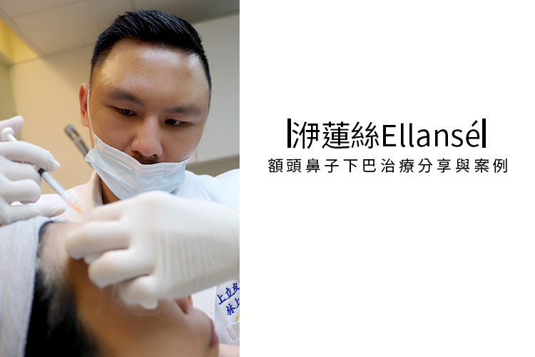林上立醫生液態拉皮上立提Ellansé 洢蓮絲少女針PolycaprolactonePCL膠原增生劑易麗適依戀詩聚己內酯 洢蓮絲眼尾下垂 洢蓮絲隆鼻墊下巴豐額額頭.jpg 林上立醫生液態拉皮上立提Ellansé 洢蓮絲少女針PolycaprolactonePCL膠原增生劑易麗適依戀詩聚己內酯 洢蓮絲眼尾下垂 洢蓮絲隆鼻墊下巴豐額額頭.jpg