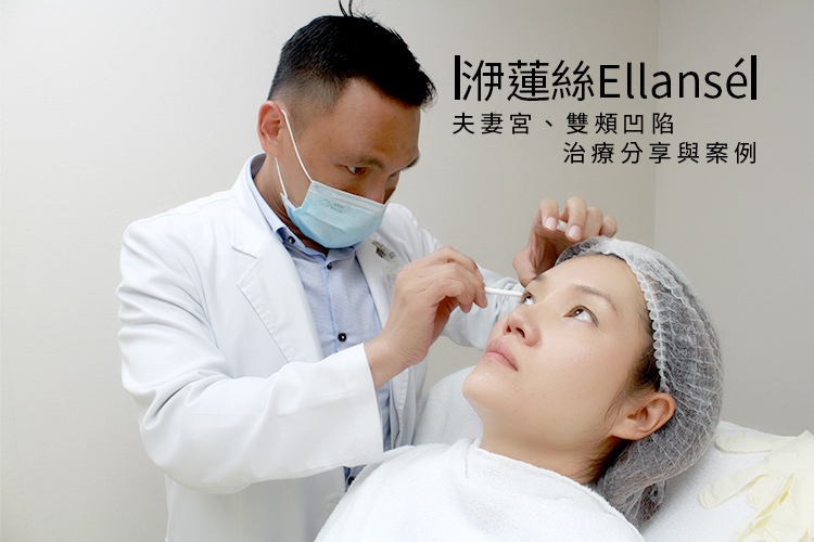 林上立醫生液態拉皮上立提Ellansé 洢蓮絲少女針PolycaprolactonePCL膠原增生劑易麗適依戀詩聚己內酯 洢蓮絲雙頰凹陷洢蓮絲豐頰洢蓮絲蘋果肌.jpg 林上立醫生液態拉皮上立提Ellansé 洢蓮絲少女針PolycaprolactonePCL膠原增生劑易麗適依戀詩聚己內酯 洢蓮絲雙頰凹陷洢蓮絲豐頰洢蓮絲蘋果肌.jpg