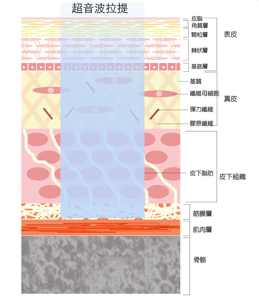 皮膚構造+治療方式2.jpg