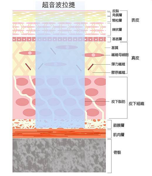 皮膚構造+治療方式2.jpg