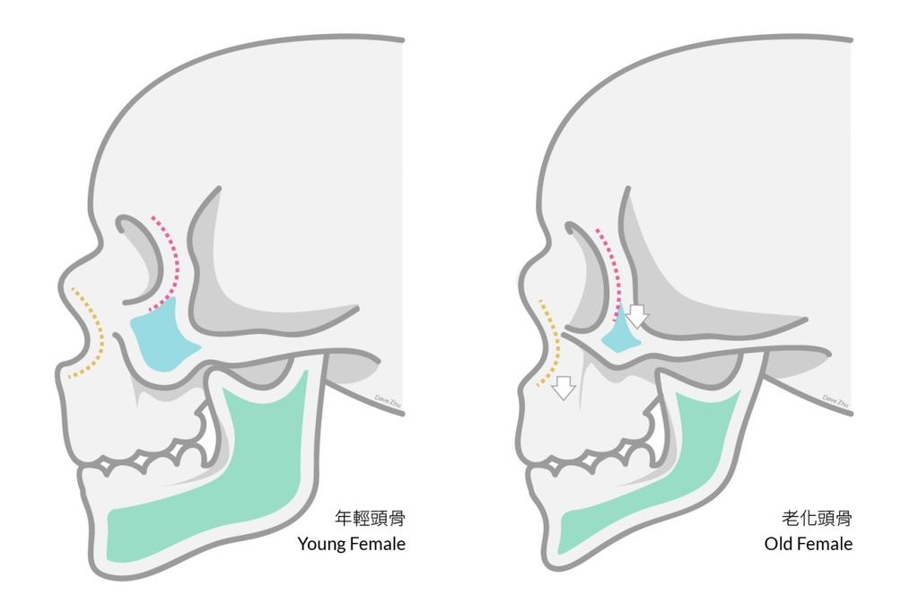 林上立醫生液態拉皮上立提Ellansé 洢蓮絲少女針PolycaprolactonePCL膠原增生劑易麗適依戀詩聚己內酯埋線拉皮3D聚左旋乳酸童顏針舒顏萃02