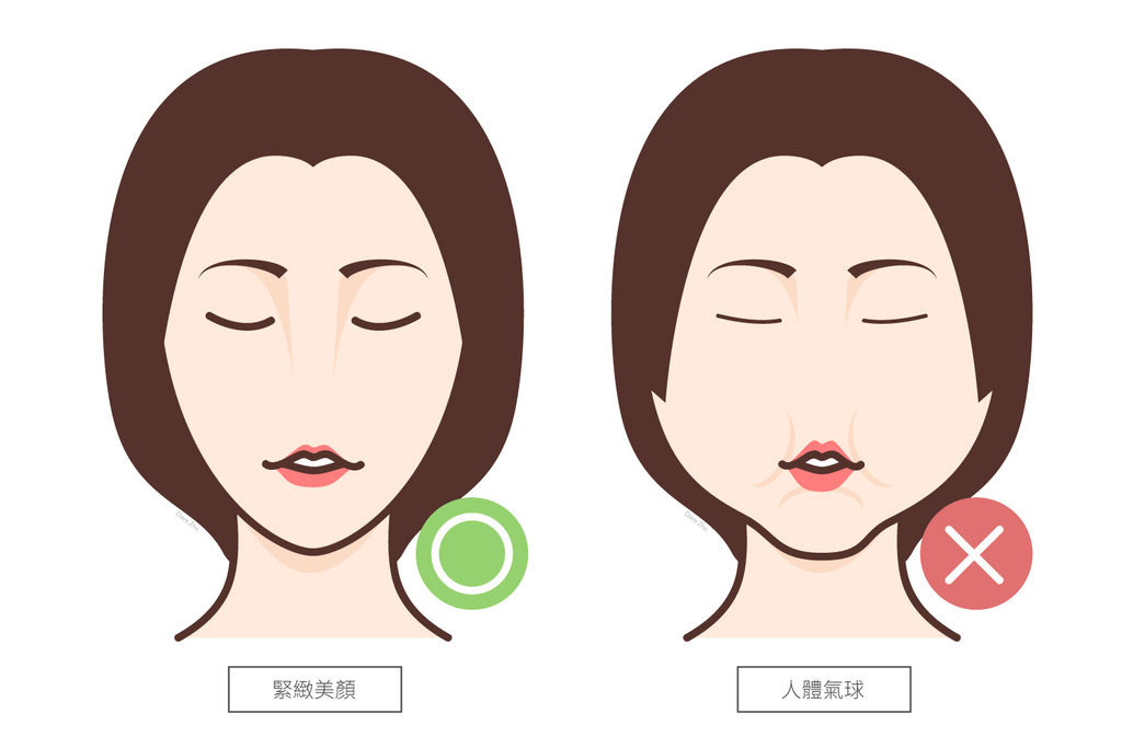 林上立醫生液態拉皮上立提Ellansé 洢蓮絲少女針PolycaprolactonePCL膠原增生劑易麗適依戀詩聚己內酯埋線拉皮3D聚左旋乳酸童顏針舒顏萃04.jpg 林上立醫生液態拉皮上立提Ellansé 洢蓮絲少女針PolycaprolactonePCL膠原增生劑易麗適依戀詩聚己內酯埋線拉皮3D聚左旋乳酸童顏針舒顏萃04.jpg