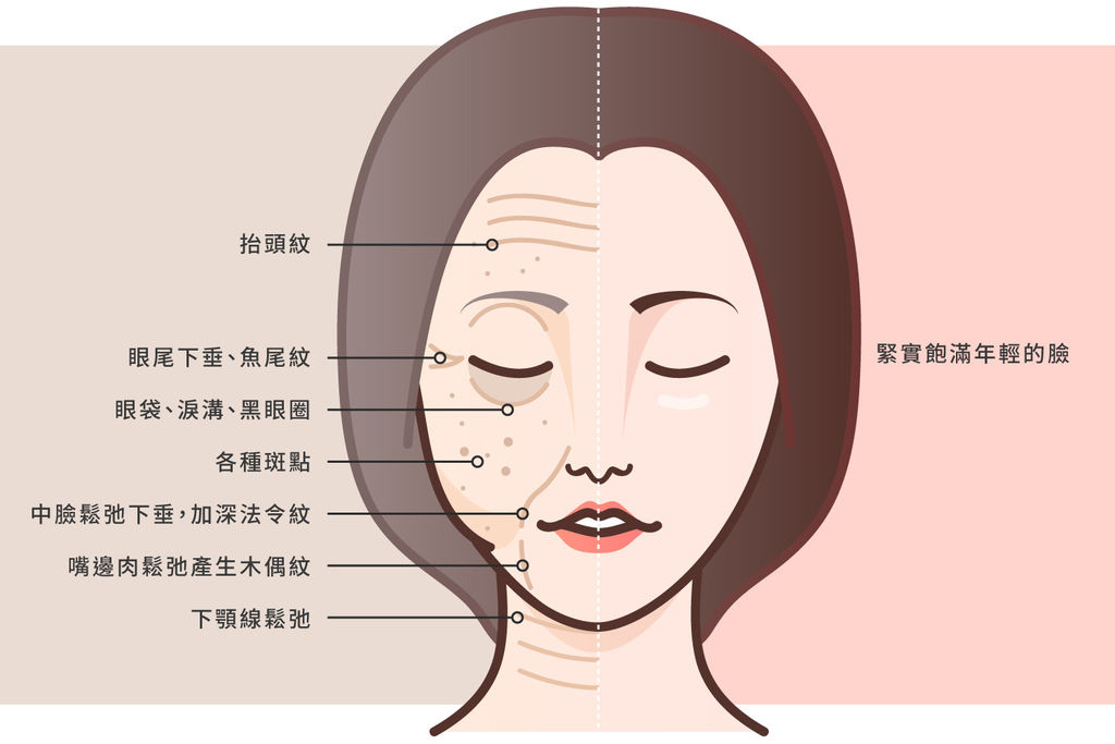 林上立醫生液態拉皮上立提Ellansé 洢蓮絲少女針PolycaprolactonePCL膠原增生劑易麗適依戀詩聚己內酯埋線拉皮3D聚左旋乳酸童顏針舒顏萃晶亮瓷微晶瓷玻尿酸液態拉皮林上立上立皮膚科01.jpg