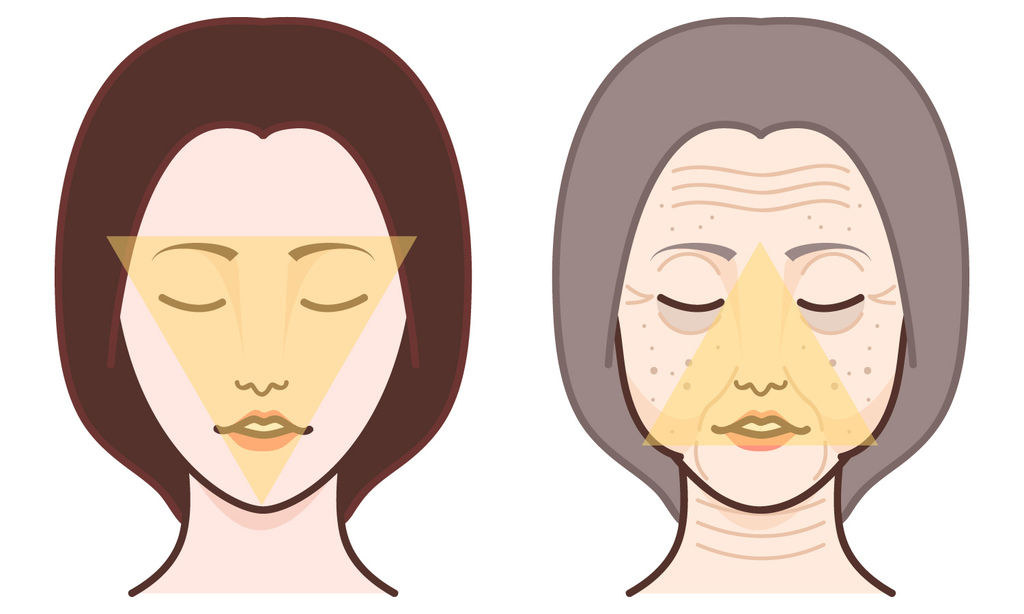 林上立醫生液態拉皮上立提Ellansé 洢蓮絲少女針PolycaprolactonePCL膠原增生劑易麗適依戀詩聚己內酯埋線拉皮3D聚左旋乳酸童顏針舒顏萃晶亮瓷微晶瓷玻尿酸液態拉皮林上立上立皮膚科04.jpg 林上立醫生液態拉皮上立提Ellansé 洢蓮絲少女針PolycaprolactonePCL膠原增生劑易麗適依戀詩聚己內酯埋線拉皮3D聚左旋乳酸童顏針舒顏萃晶亮瓷微晶瓷玻尿酸液態拉皮林上立上立皮膚科04.jpg