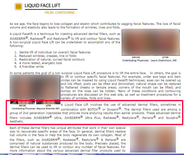 液態拉皮上立提聚己內酯少女針洢蓮絲依戀詩ellanse童顏針3D聚左旋乳酸舒顏萃1 液態拉皮上立提聚己內酯少女針洢蓮絲依戀詩ellanse童顏針3D聚左旋乳酸舒顏萃1