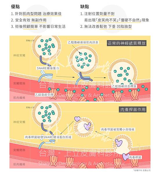 林上立醫生液態拉皮上立提Ellansé 洢蓮絲少女針PolycaprolactonePCL膠原增生劑易麗適依戀詩聚己內酯埋線拉皮3D聚左旋乳酸童顏針舒顏萃肉毒桿菌01.jpg