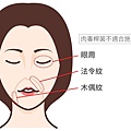 林上立醫生液態拉皮上立提Ellansé 洢蓮絲少女針PolycaprolactonePCL膠原增生劑易麗適依戀詩聚己內酯埋線拉皮3D聚左旋乳酸童顏針舒顏萃肉毒桿菌05.jpg