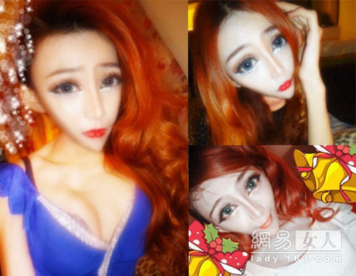 林上立醫生液態拉皮上立提Ellansé 洢蓮絲少女針PolycaprolactonePCL膠原增生劑易麗適依戀詩聚己內酯3D聚左旋乳酸童顏針舒顏萃04.jpg 林上立醫生液態拉皮上立提Ellansé 洢蓮絲少女針PolycaprolactonePCL膠原增生劑易麗適依戀詩聚己內酯3D聚左旋乳酸童顏針舒顏萃04.jpg