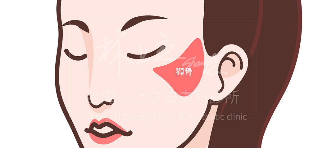 林上立醫生液態拉皮上立提Ellansé 洢蓮絲少女針PolycaprolactonePCL膠原增生劑易麗適依戀詩聚己內酯3D聚左旋乳酸童顏針舒顏萃蘋果肌05.jpg 林上立醫生液態拉皮上立提Ellansé 洢蓮絲少女針PolycaprolactonePCL膠原增生劑易麗適依戀詩聚己內酯3D聚左旋乳酸童顏針舒顏萃蘋果肌05.jpg