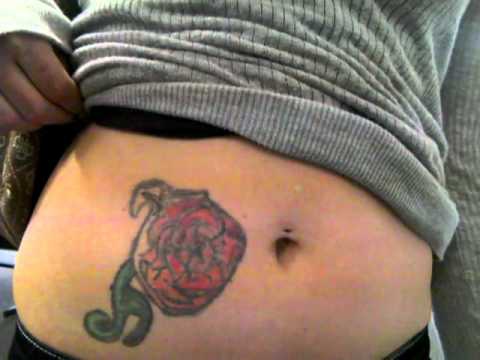 755蜂巢皮秒雷射除細紋除刺青除皺紋除毛孔消除刺青蜂巢透鏡上立皮膚科 (4).jpg 755蜂巢皮秒雷射除細紋除刺青除皺紋除毛孔消除刺青蜂巢透鏡上立皮膚科 (4).jpg