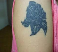 755蜂巢皮秒雷射除細紋除刺青除皺紋除毛孔消除刺青蜂巢透鏡上立皮膚科 (6).jpg 755蜂巢皮秒雷射除細紋除刺青除皺紋除毛孔消除刺青蜂巢透鏡上立皮膚科 (6).jpg