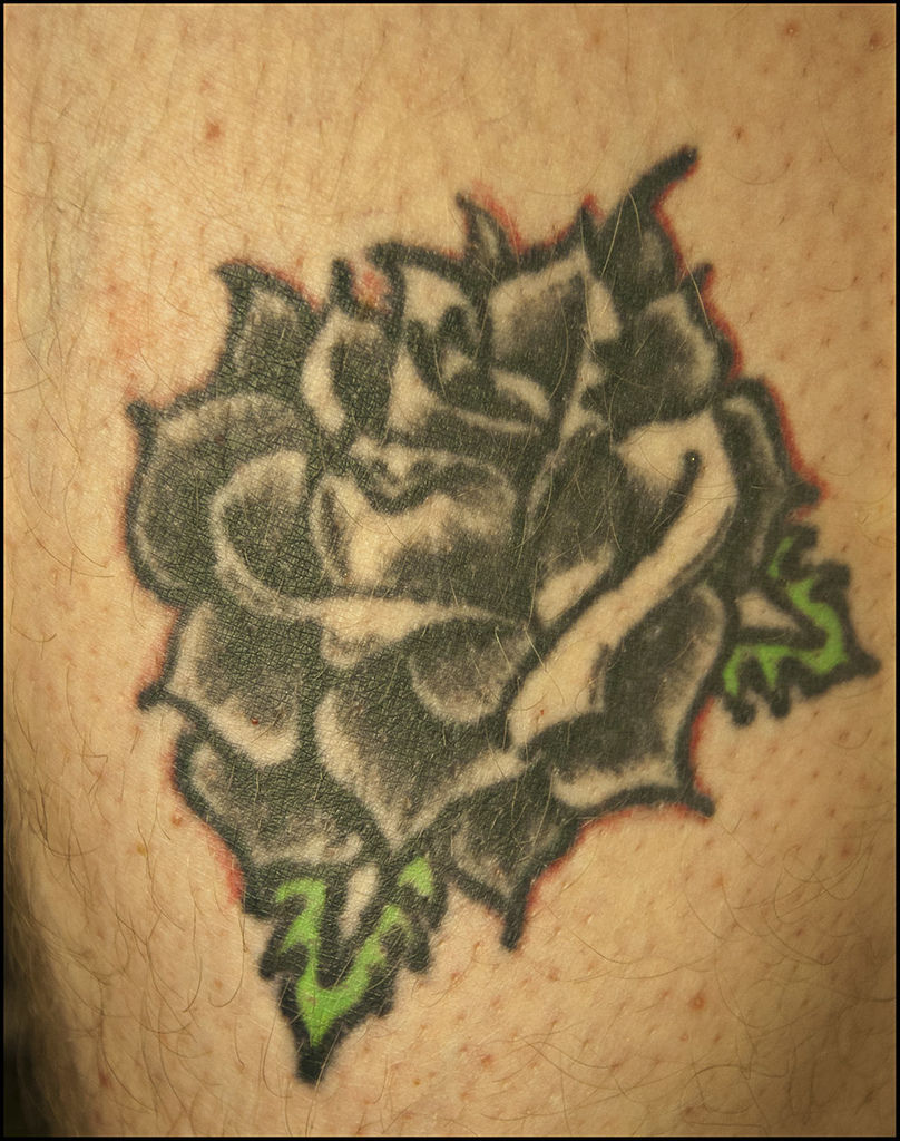 755蜂巢皮秒雷射除細紋除刺青除皺紋除毛孔消除刺青蜂巢透鏡上立皮膚科 (7).jpg 755蜂巢皮秒雷射除細紋除刺青除皺紋除毛孔消除刺青蜂巢透鏡上立皮膚科 (7).jpg