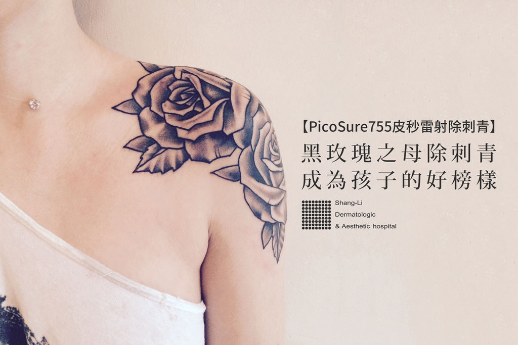 755蜂巢皮秒雷射除細紋除刺青除皺紋除毛孔消除刺青蜂巢透鏡上立皮膚科 (15).jpg 755蜂巢皮秒雷射除細紋除刺青除皺紋除毛孔消除刺青蜂巢透鏡上立皮膚科 (15).jpg
