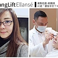 少女計劃林上立醫生液態拉皮上立提 液態拉皮 推薦 Ellansé 洢蓮絲少女針PolycaprolactonePCL膠原增生劑易麗適依戀詩拉皮緊實鬆垮下垂膠原蛋白增生