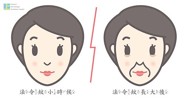 Ellanse洢蓮絲上立微整教室法令紋細紋法令紋木偶紋老化膠原蛋白流失 (2).jpg