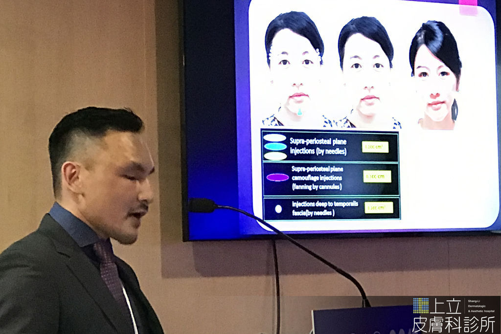 林上立醫師PicoSure755皮秒雷射蜂巢透鏡Ellanse洢蓮絲 林上立醫師PicoSure755皮秒雷射蜂巢透鏡Ellanse洢蓮絲