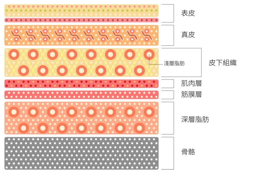 林上立醫生液態拉皮上立提Ellansé 洢蓮絲少女針PolycaprolactonePCL膠原增生劑易麗適依戀詩聚己內酯埋線拉皮3D聚左旋乳酸童顏針舒顏萃晶亮瓷微晶瓷玻尿酸液態拉皮林上立上立皮膚科08