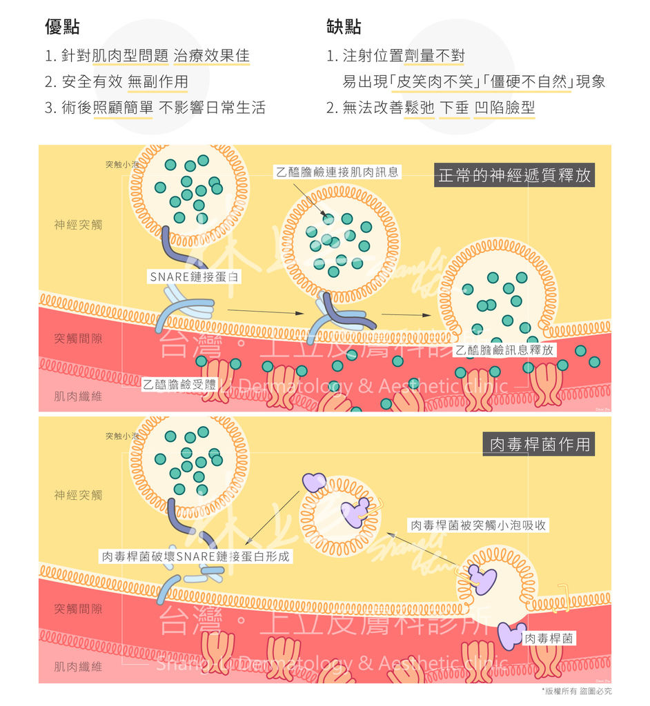 液態拉皮上立皮膚科抗老治療拉提老化膠原蛋白肉毒桿菌Ellanse洢蓮絲填補凹陷除皺 (2).jpg