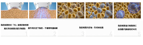 冷凍減脂MICOOL低溫輔助減脂馬甲線六塊肌抽脂冷凍溶脂8.png