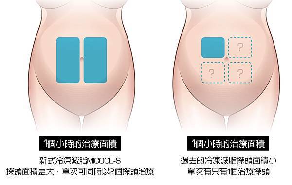 冷凍溶脂冷凍減脂非侵入式體雕抽脂副作用肚子瘦手臂大腿5