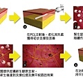 洢蓮絲ellanse聚己內酯依戀詩易麗適少女針奇蹟針液態拉皮二代童顏針膠原蛋白增生洢蓮絲費用價格洢蓮絲價位林上立上立皮膚科診所淚溝法令紋3