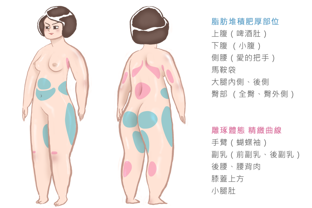 冷凍溶脂冷凍減脂非侵入式體雕抽脂副作用肚子瘦手臂大腿小腹屁股sculpsure1