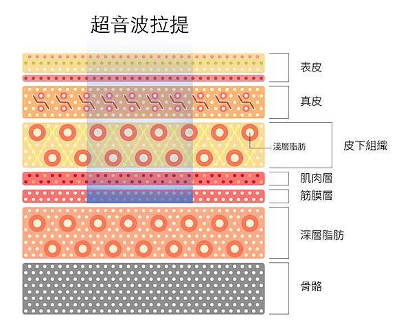 超音波拉提超音波拉皮超聲刀極線音波拉皮極線音波拉提筋膜拉皮下顎線費用價位推薦效果美國機音波拉皮因波拉提術後保養腫推薦醫師林上立上立皮膚科診所多少錢幾條液態拉皮(6).jpg