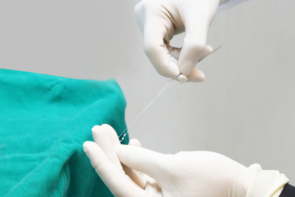 埋線拉皮費用埋線拉提失敗臉部埋線價格臉部埋線效果埋線拉提副作用埋線拉提推薦埋線拉皮術後埋線臉部價格4D埋線拉皮埋線拉皮推薦埋線種類林上立醫師推薦醫師液態拉皮上立提1.JPG 埋線拉皮費用埋線拉提失敗臉部埋線價格臉部埋線效果埋線拉提副作用埋線拉提推薦埋線拉皮術後埋線臉部價格4D埋線拉皮埋線拉皮推薦埋線種類林上立醫師推薦醫師液態拉皮上立提1.JPG