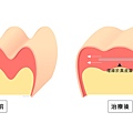 埋線拉皮費用埋線拉提失敗臉部埋線價格臉部埋線效果埋線拉提副作用埋線拉提推薦埋線拉皮術後埋線臉部價格4D埋線拉皮埋線拉皮推薦埋線種類林上立醫師推薦醫師液態拉皮上立提3.jpg