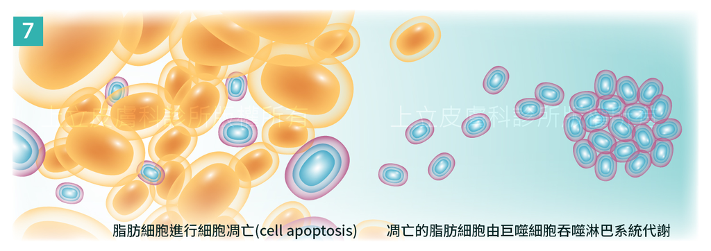 MICOOL-S冷凍溶脂效果冷凍溶脂價錢冷凍減脂心得冷凍溶脂推薦冷凍溶脂ptt冷凍溶脂原理冷凍溶脂術後瘦肚子的方法快速瘦肚子運動瘦肚子按摩快速瘦小腹運動瘦肚子飲食瘦肚子06.png